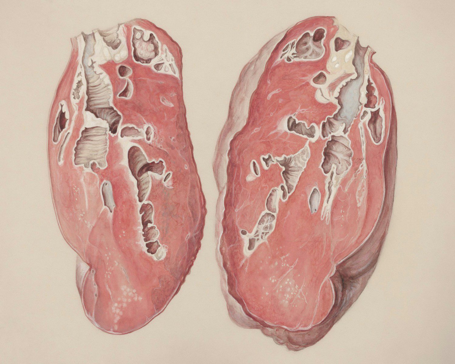 a drawing of a pair of lungs