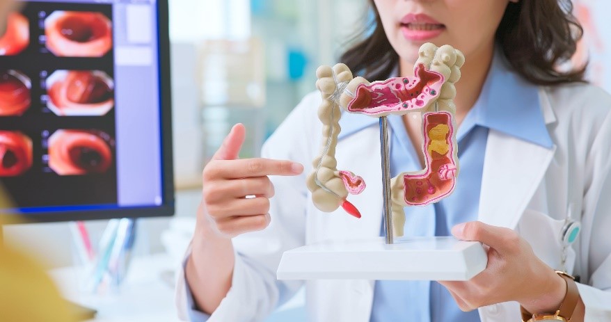 What to Expect During a Colonoscopy | Your GI Center Houston