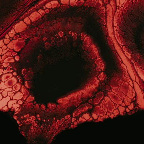 brown and black cracked skin